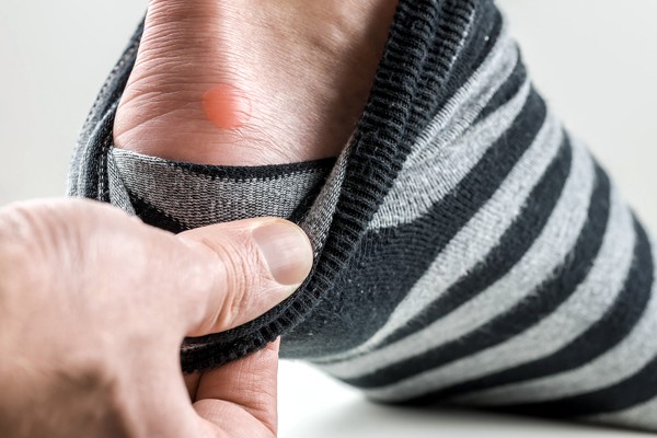 foot-problems-blisters